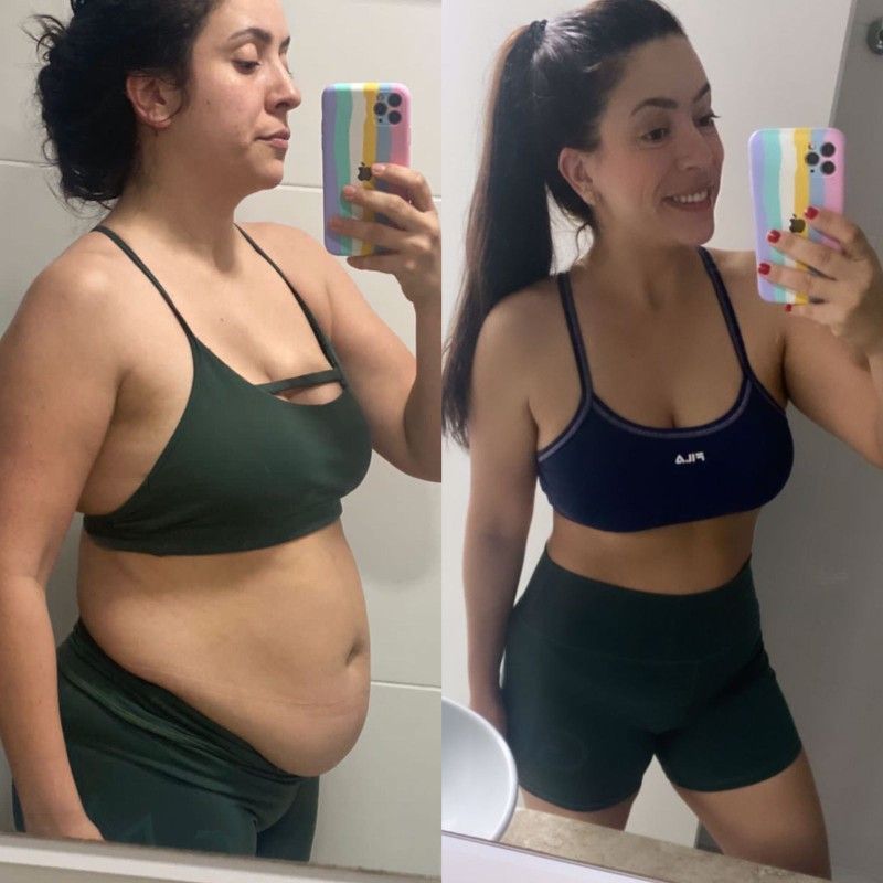 Antes e depois de paciente