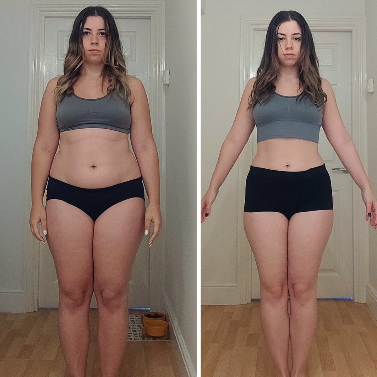 Antes e depois de paciente