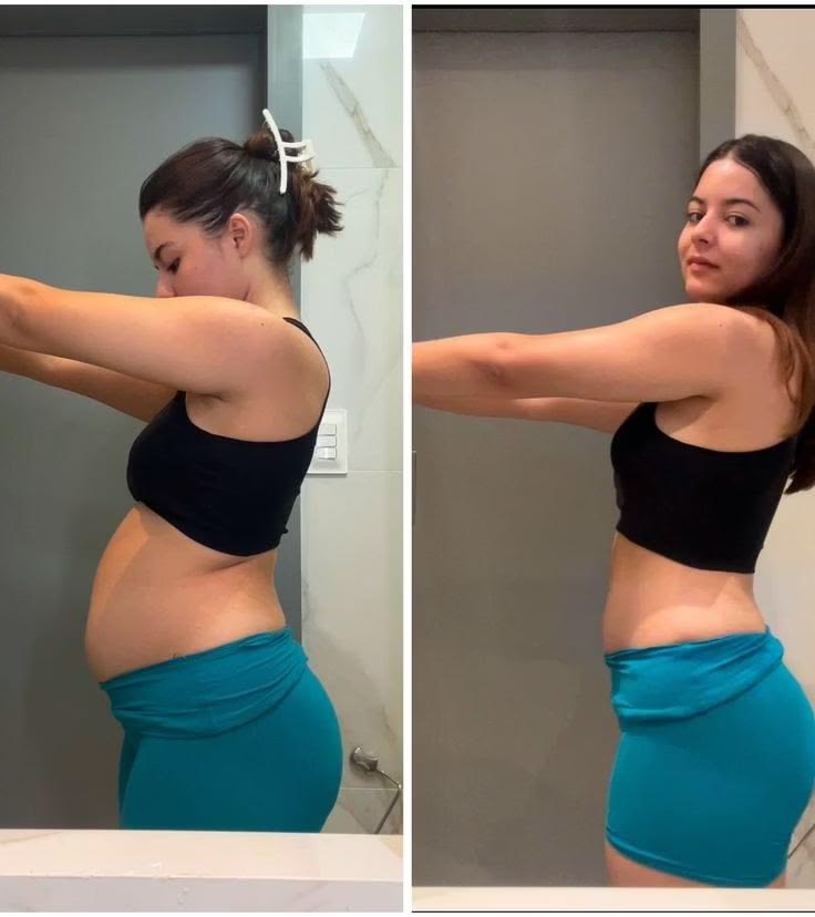 Antes e depois de paciente