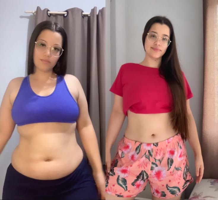 Antes e depois de paciente