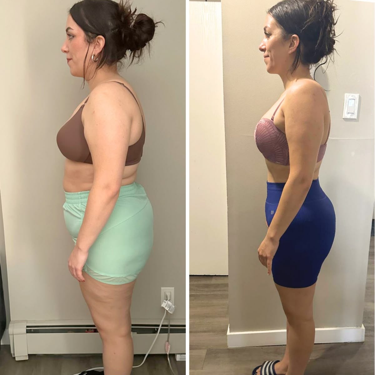 Antes e depois de paciente