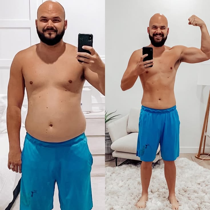 Antes e depois de paciente