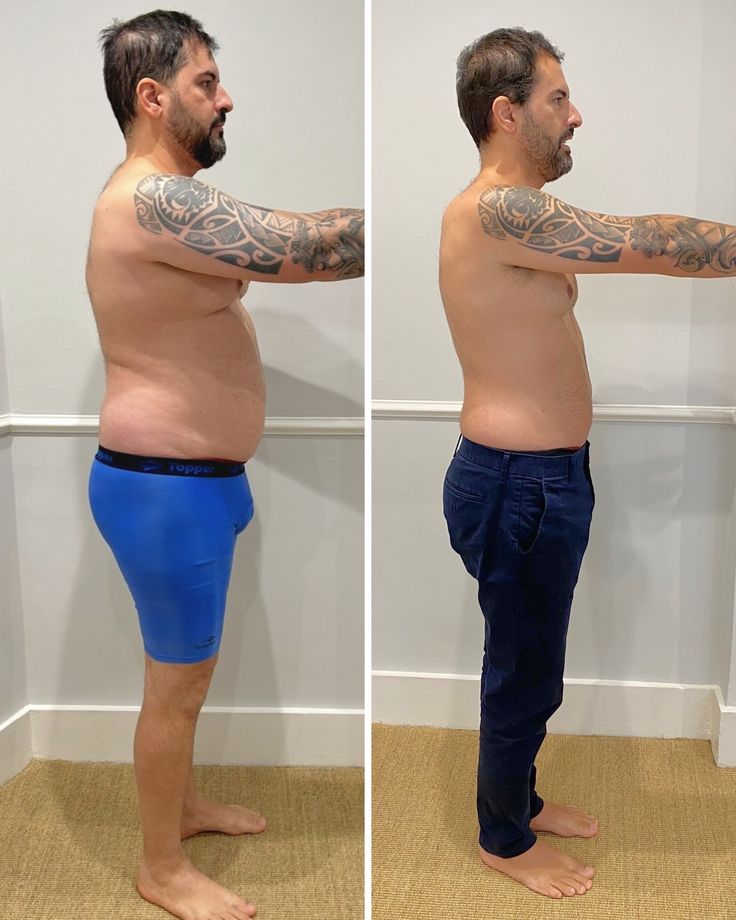 Antes e depois de paciente