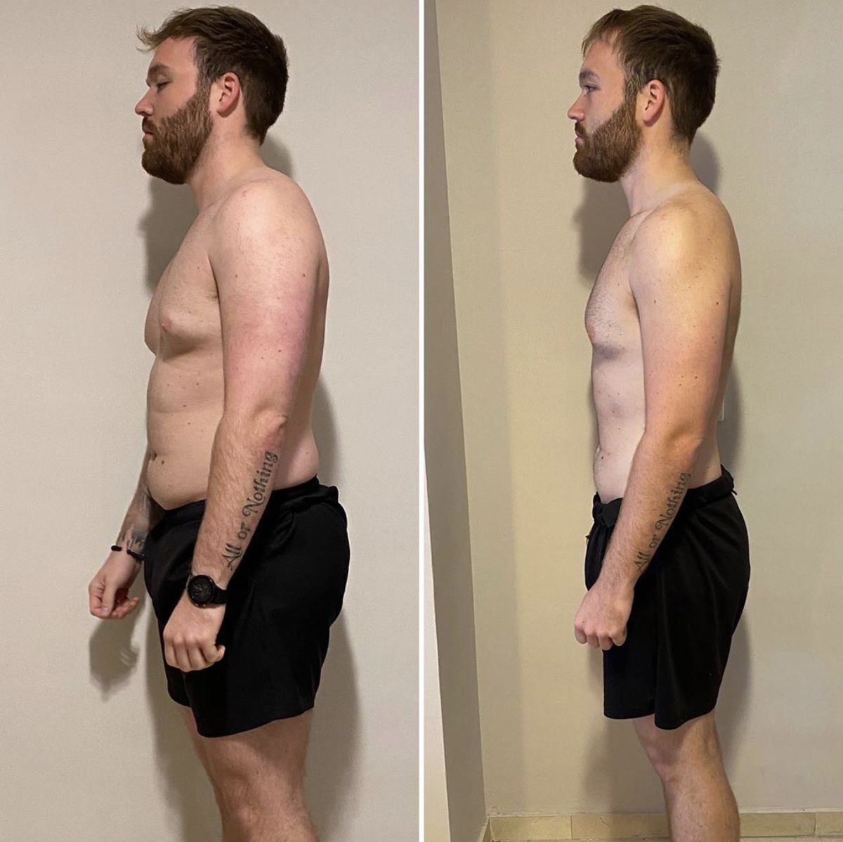 Antes e depois de paciente