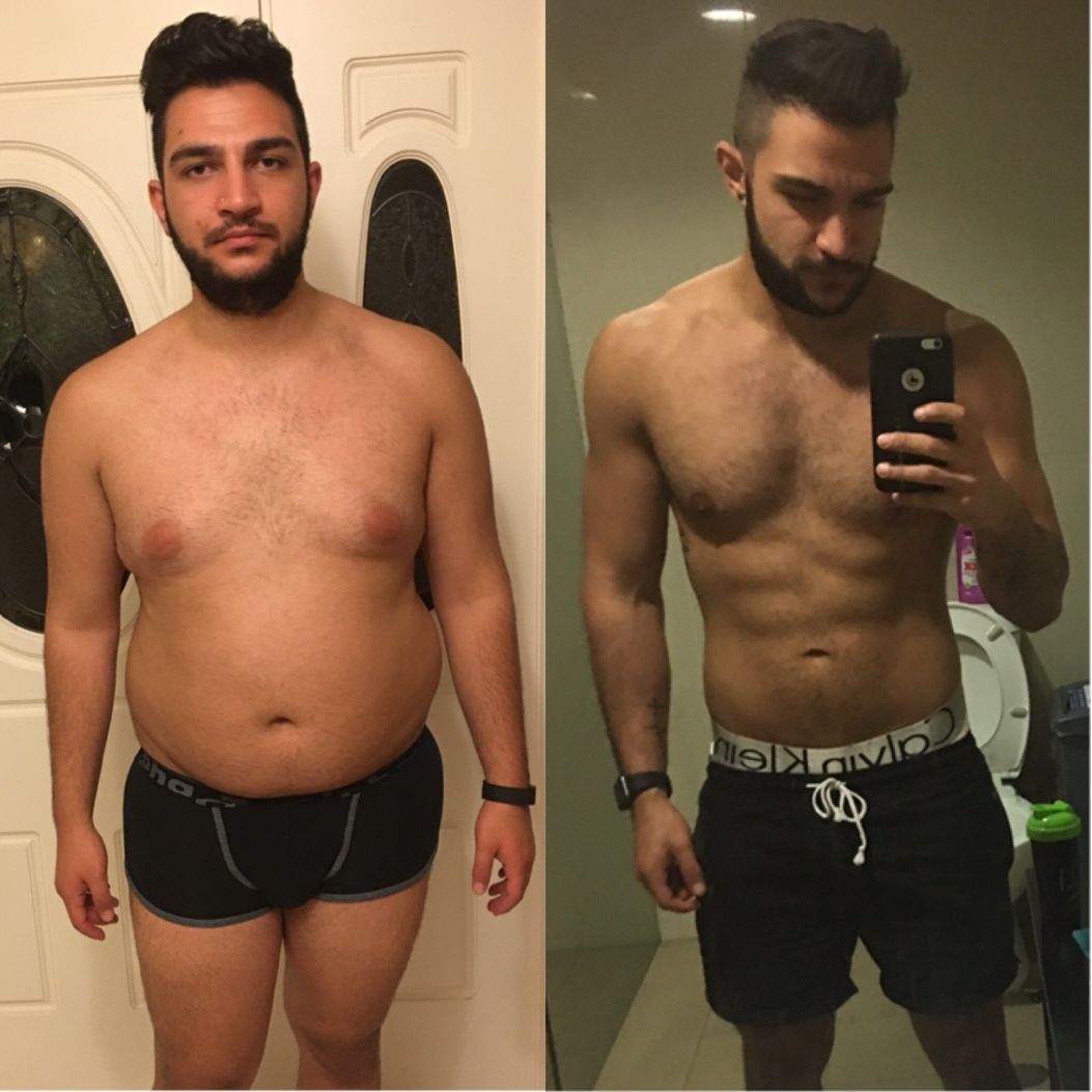Antes e depois de paciente
