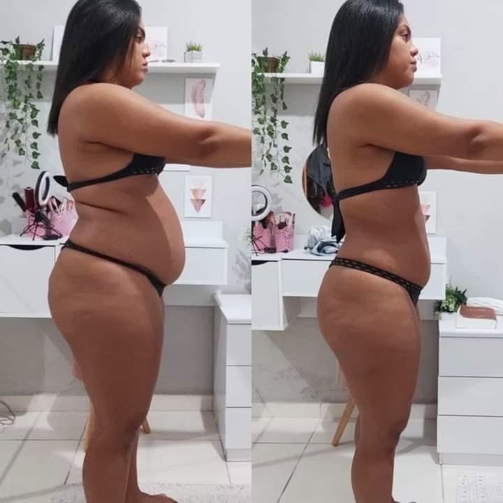 Antes e depois de paciente